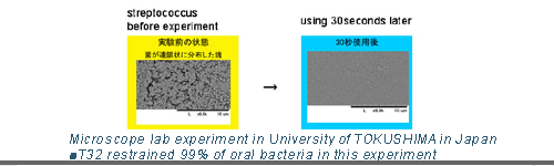 supersonic toothbrush
